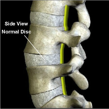 The Most Commonly Prescribed Medications for Spinal Disc Pain