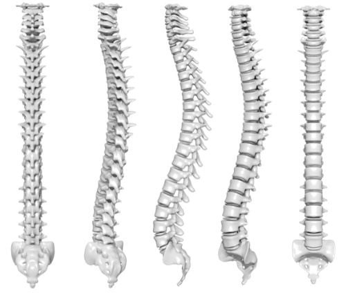 What is the difference between a Bulging Disc, Herniated Disc, Ruptured Disc, and Degenerative Disc Disease?